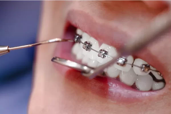 dentists-check-the-teeth-and-braces-the-patients-i-2026-01-07-00-11-44-utc.webp